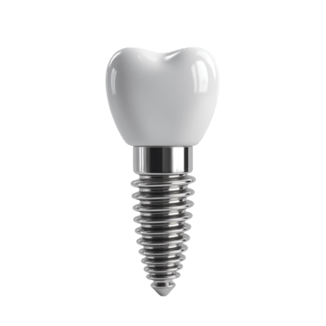 Implant Dentar Premium