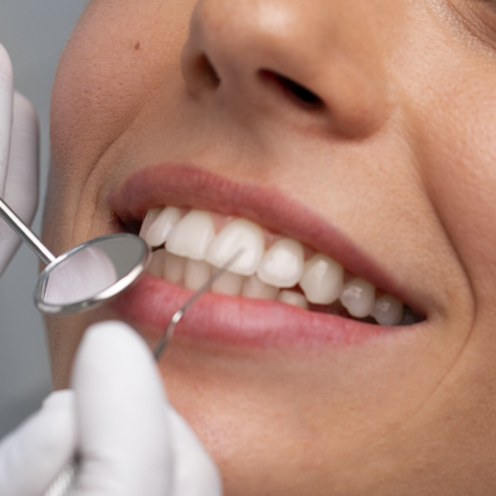 Estetică dentară